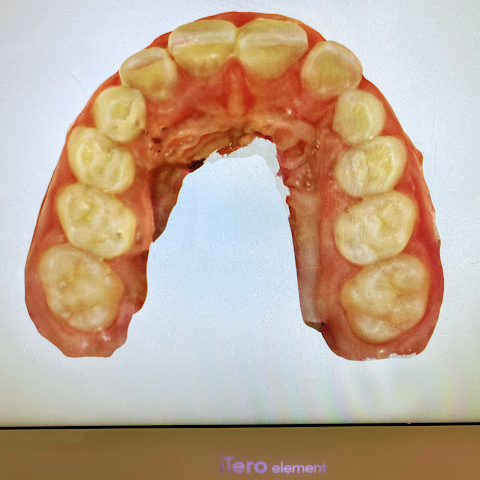 Dott.ssa Elena Papuzzo | Dentista Bambini