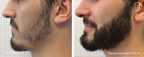 Pallaoro Medical Laser - Chirurgia estetica