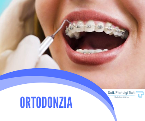 Studio Odontoiatrico Dott Pierluigi Torti | Dentista