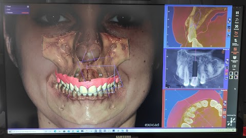 Dental Cad Design