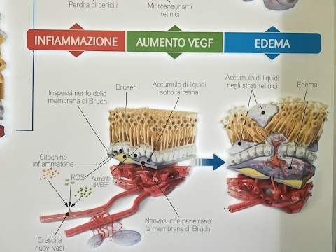 Centro di Microchirurgia Oftalmica di Dott. Tritto Martino