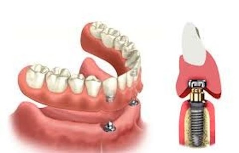 Dental Service Srls Ambulatorio Odontoiatrico