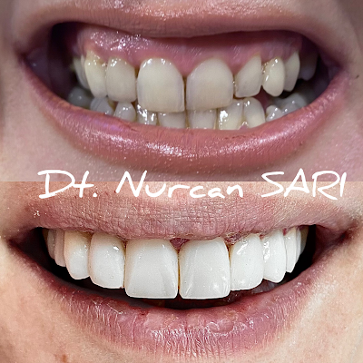 photo of Özel Mustafa Kemal Ağız ve Diş Sağlığı Polikliniği / Implant Center Turkey Dental Clinic