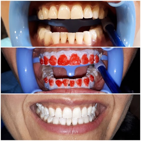 Studio Dentistico di Odontoiatria Estetica Della Rocca