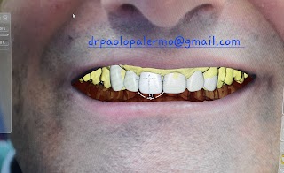 Dentista Milano DOTT PAOLO PALERMO BIO KLINIC