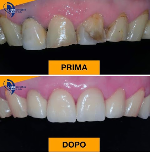 Studio Dentistico Dott. Di Gioia Andrea