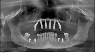 Zenadent, Studio dentistico Schirripa