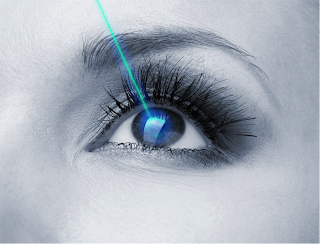 Vista Vision Messina - Clinica Oculistica