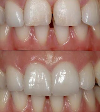 Studio Dentistico Super Implant