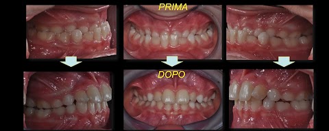 Ortodonzia Microdent Bologna