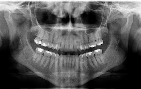 Studio Dentistico Dott. Rinaldi Giovanni Fonte Nuova Roma