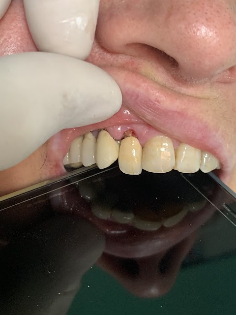 Dottor Vincenzo Esposito Dentista specialista ambulatoriale patologia orale