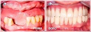 Studio Dentistico Piccolo