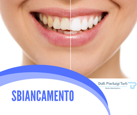 Studio Odontoiatrico Dott Pierluigi Torti | Dentista