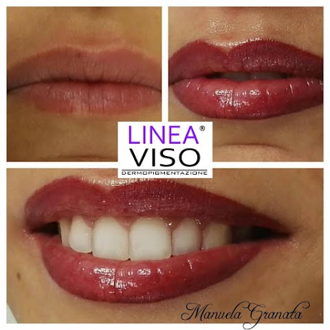 Linea Viso