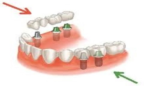 Dental Service Srls Ambulatorio Odontoiatrico