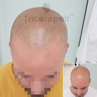 TricoRepair - Tricopigmentazione Specialistica