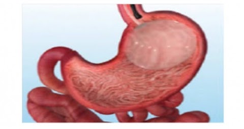 Dott. Gennaro Martines, Chirurgo generale,chirurgo bariatrico,proctologo, chirurgia laparoscopica,chirurgia colo-rettale,endoscopia digestiva diagnostica e operativa