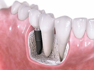 Centro Medico San Marco Srl - Odontoiatria -Protesi dentaria- Implantologia - Ortodonzia - unica sede - Dir. Sanitario Dott. Spina Francesco