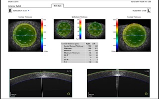 Centro Diagnosi Oculare