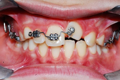 Studio Dentistico del Dott. Allocca Andrea Specialista In Ortodonzia