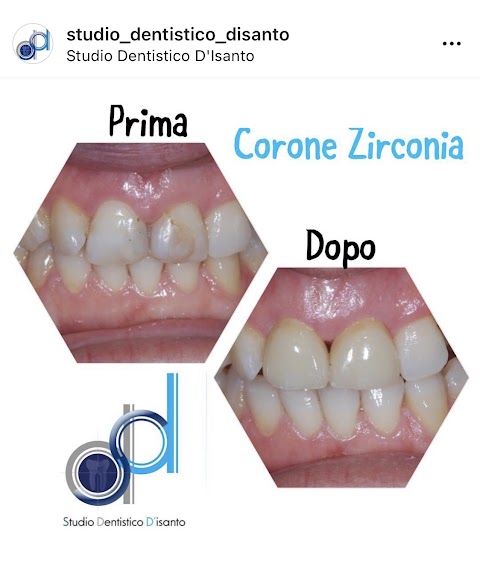 Studio Dentistico D'Isanto