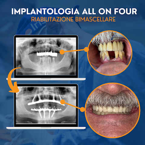 Dottor Cesare Paoleschi Firenze - Esperto Implantologia Dentale