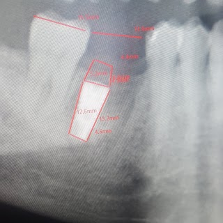 Dott. Bin Clinica Dentale