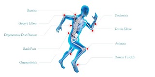 ORTHOPEDIC EXCELLENCE TREATMENT ITALY