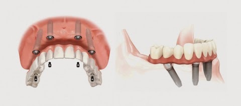 Dentista San Giovanni Valdarno - Iris Compagnia Odontoiatrica (Dr. Cesare Paoleschi)