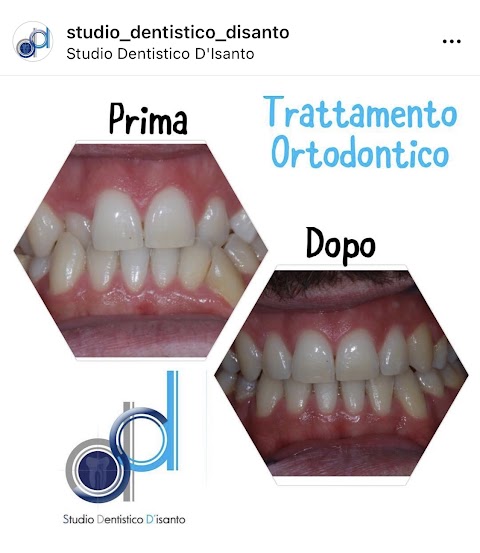 Studio Dentistico D'Isanto