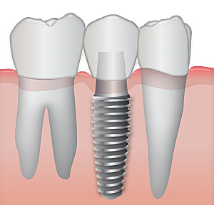 Studio dentistico Prof. e Dott. Makarati