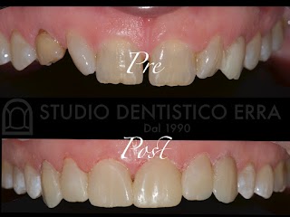 Studio Dentistico Dr. Erra - Odontoiatria, Gnatologia, Ortodonzia e Implantologia