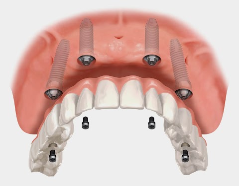 Dentista Arezzo - Iris Compagnia Odontoiatrica (Dr. Cesare Paoleschi)