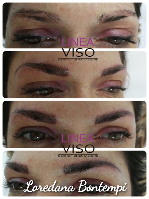 Linea Viso