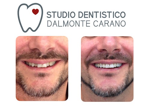 Studio Dentistico Dalmonte Carano del Dr. Raffaello Dalmonte e del Dr. Michelangelo Carano