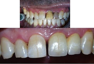 Studio di Odontoiatria Protesi Implantare ed Ortodonzia Dott.M.Sicilia