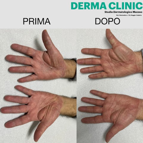 DERMA CLINIC-Studio Dermatologico-Venereologico-Laser Mazzeo,Reggio Calabria