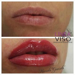 Linea Viso