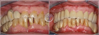 Clinica Odontoiatrica Dr. Ruzza - Dentista Lissone