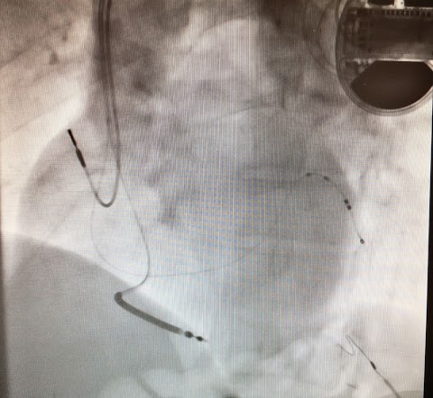 Cardiologo Ferrara Aritmologo - Dott Placentino Filippo