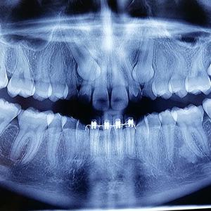 Studio Odontoiatrico Pareschi | Dentista Ferrara
