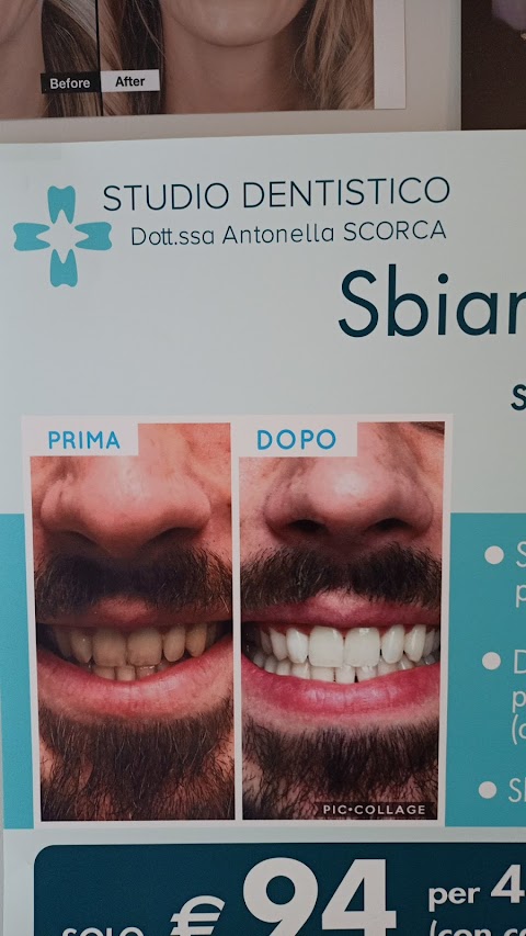 Studio Dentistico Scorca INVISALIGN | Dentista Bari | Sbiancamento | Impianti Dentali | Apparecchio Invisibile