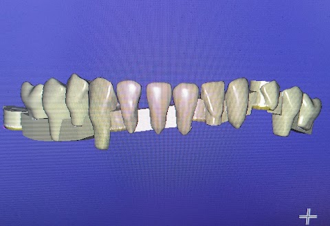 DENTAL FERONIA di Vernarecci Massimo e Vecchio Maurizio