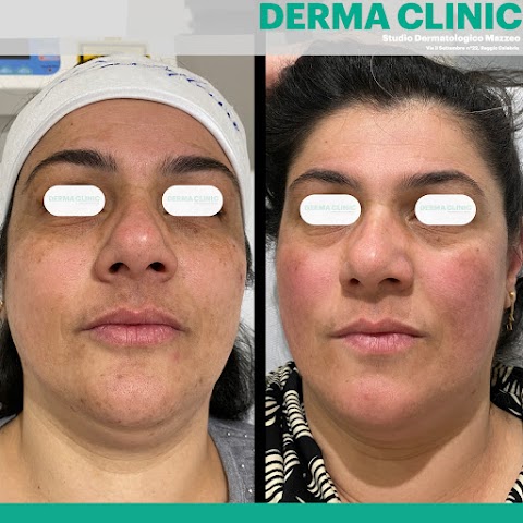 DERMA CLINIC-Studio Dermatologico-Venereologico-Laser Mazzeo,Reggio Calabria