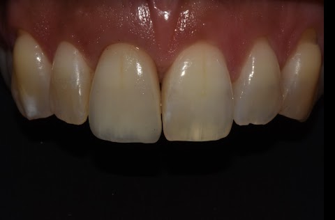 Studio Dentistico SmileDENT I Centro di Implantologia e Protesi Dentaria a Bari I Chirurgo Impianti dentali Bari