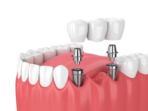 Studio dentistico Codegoni Dentista esperto in Terapia Laser