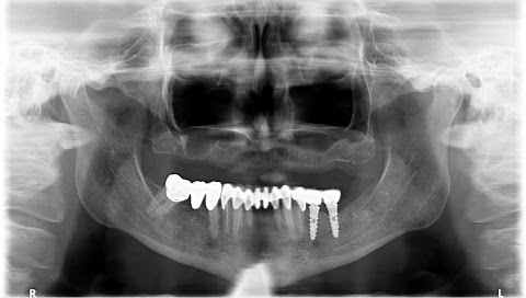 Dottor Cesare Paoleschi Firenze - Esperto Implantologia Dentale