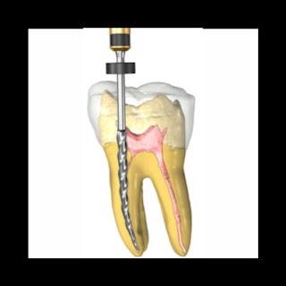 Dimadent Studio Dentistico Dott. Di Mauro Salvatore