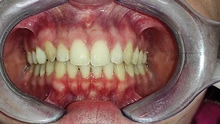 Dentista a Siracusa | Studio Dentistico Gionfriddo